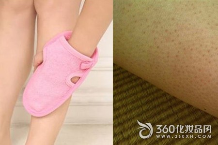 Chicken skin Gentle exfoliating Moisturizing skin Correct care