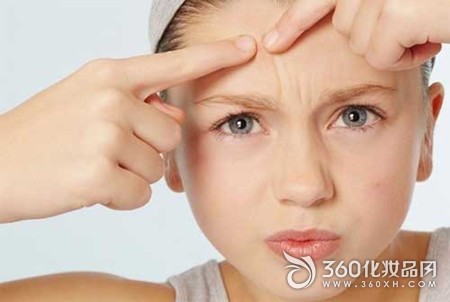 How to adjust the forehead acne? Forehead acne cause acne method