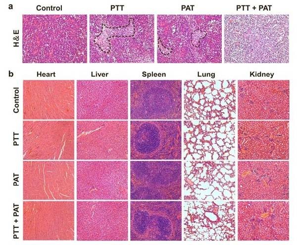 ACS nanoï¼šç”Ÿç‰©æ­£äº¤ååº”æ´»åŒ–è‚¿ç˜¤é¶å‘çº³ç±³é¢—ç²’ç”¨äºŽä½“å†…æˆåƒ