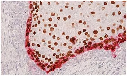 Cellï¼šé‡ç£…ï¼é¦–æ¬¡æž„å»ºå‡ºäººå¤´é¢ˆç™Œçš„å®Œæ•´ç»†èƒžå›¾è°±