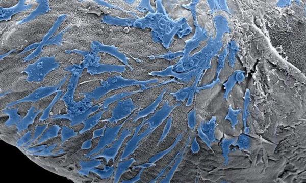 ç§‘å­¦å®¶åˆ©ç”¨â€œå¢¨æ°´â€å’Œ3Dæ‰“å°æŠ€æœ¯ç ”åˆ¶äººä½“ç»†èƒžç»“æž„
