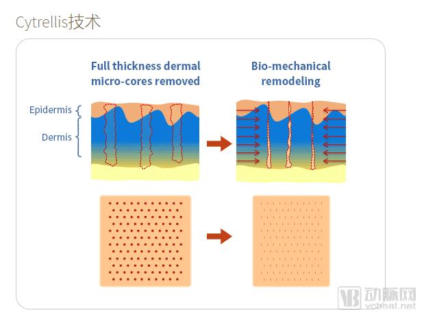 çš®è‚¤æŠ—è¡°æŠ€æœ¯å…¬å¸Cytrelliså®Œæˆ2850ä¸‡ç¾Žå…ƒBè½®èžèµ„