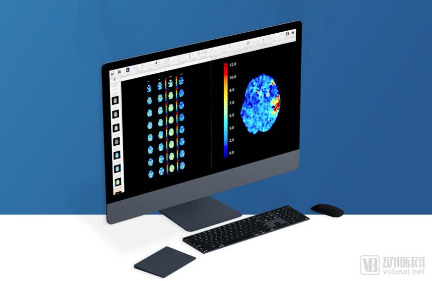 è„‘å’ä¸­AIæ£€æµ‹å…¬å¸Viz.aiå®Œæˆèžèµ„ï¼Œç”±KPCBå’Œè°·æ­Œæ——ä¸‹åŸºé‡‘å…±åŒæŠ•èµ„