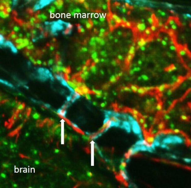 æ–°é€”å¾„ï¼ç§‘å­¦å®¶å‘çŽ°éª¨é«“å…ç–«ç»†èƒžå¿«é€Ÿè¿›å…¥å¤§è„‘çš„ç§˜å¯†é€šé“