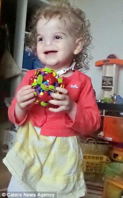 è‹±å›½é¦–ä¾‹3Dæ‰“å°é¼»å­æˆåŠŸæ¤å…¥ä¸¤å²å°å¥³å­©è„¸ä¸Š