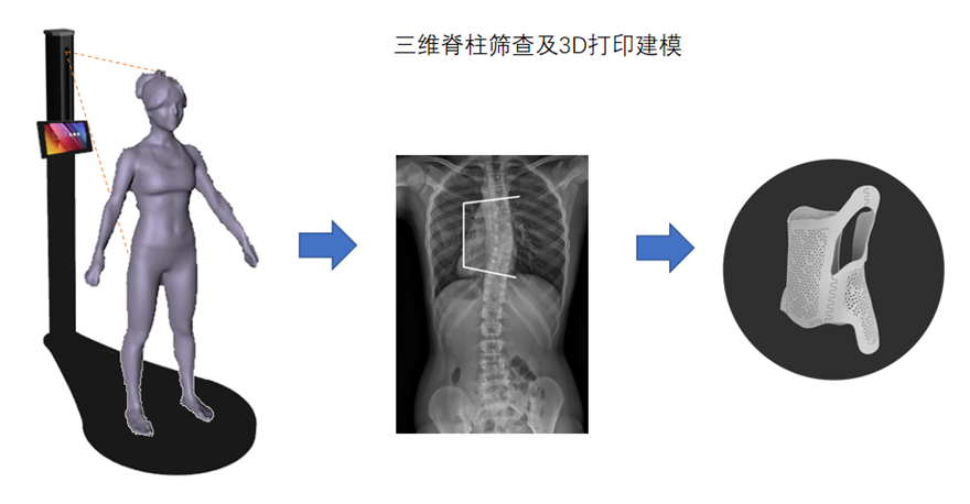 æ­¥å½±åŒ»ç–—é€šè¿‡AIè§†è§‰æŠ€æœ¯èšç„¦é’å°‘å¹´è„ŠæŸ±ä¾§å¼¯ç—…ç§