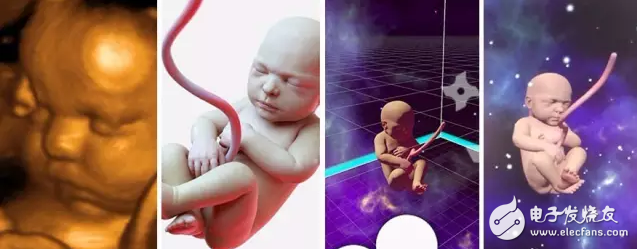 VR also has this special purpose: let you see unborn baby in advance