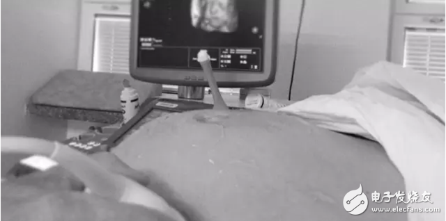 VR also has this special purpose: let you see unborn baby in advance