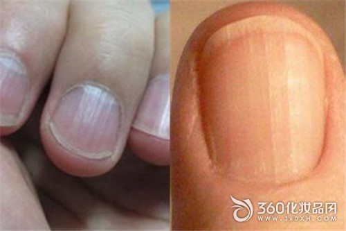 Nail vertical stripes