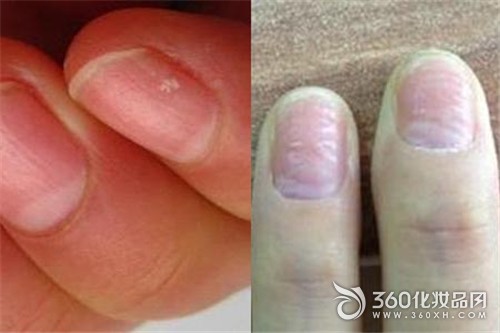 Nail vertical stripes