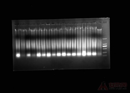 Rna electrophoresis picture