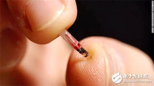 Challenge your nerves â€“ implantable electronics!