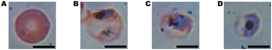 Duke University designs new technologies for holographic medical imaging and diagnosis of malaria