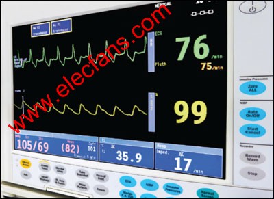 ECG and blood oxygen readings displayed on the patient monitor