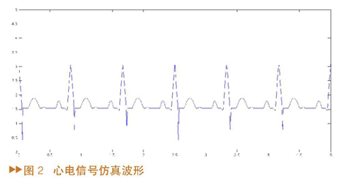 ECG signal simulation waveform