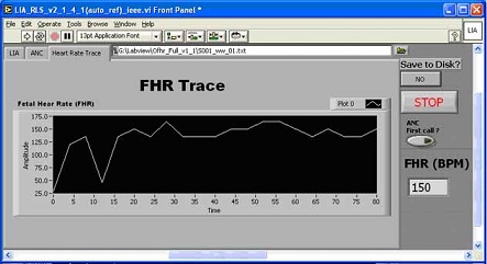 Graphical user interface of OFHR system