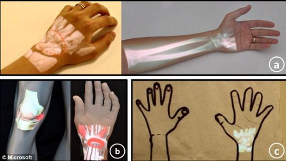 Scientists develop a handheld X-ray instrument, and images are displayed directly on the skin