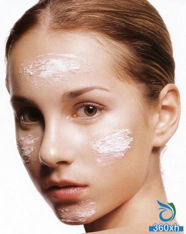 Dry skin in winter