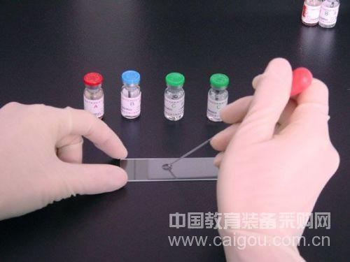 Research confirms that chicken is one of the sources of human infection with H7N9 avian influenza virus