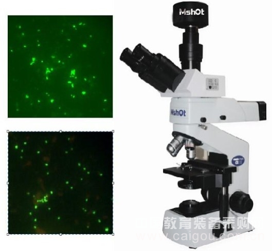 Application of Mingmei LED Fluorescence Microscope in Detection of Genital Diseases