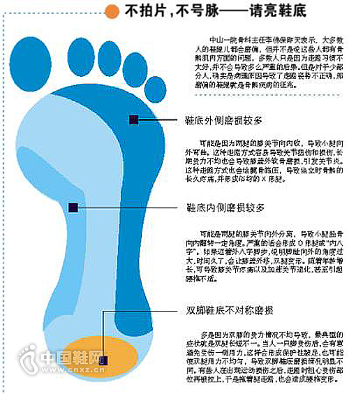 çœ‹éž‹ç£¨æŸä½ç½®èƒ½çœ‹ç—…