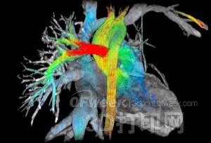 3D printing has OUT? GE Healthcare develops seven-dimensional imaging technology