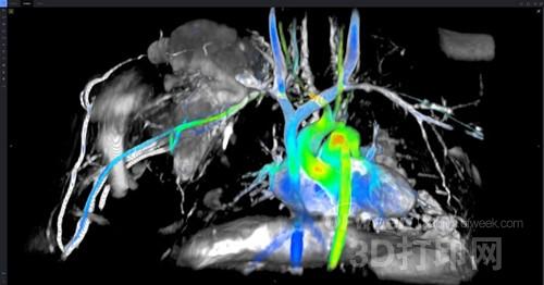 3D printing has OUT? GE Healthcare develops seven-dimensional imaging technology