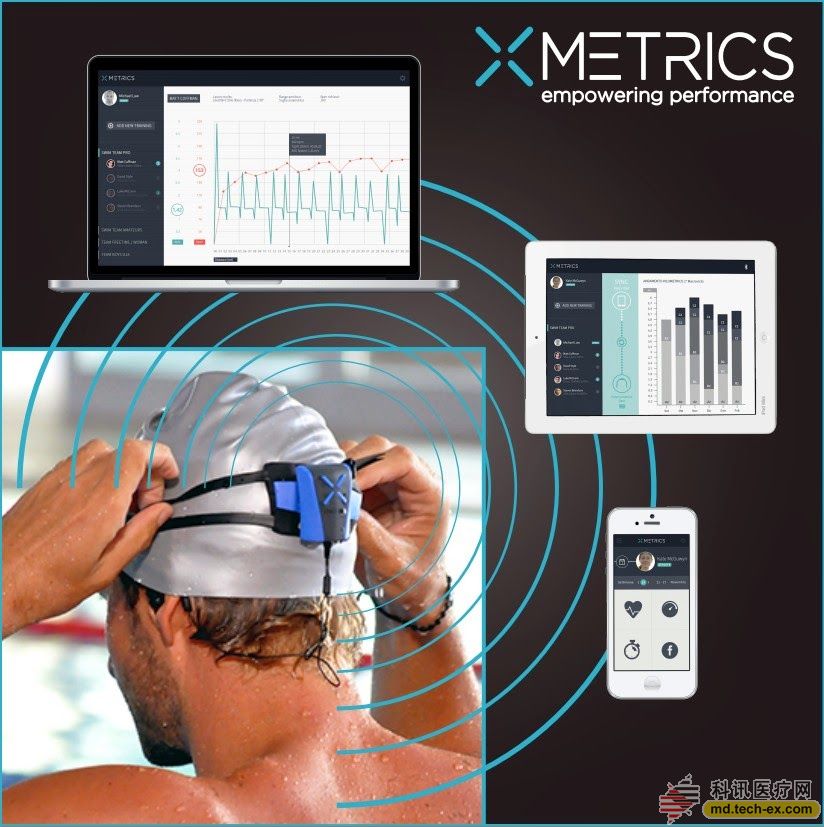 Xmetrics