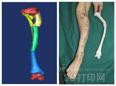 Inventory of domestic hospitals that have used 3D printing for clinical surgery