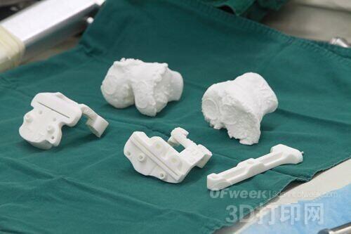 Metal 3D printing opens a new era of hard tissue medical