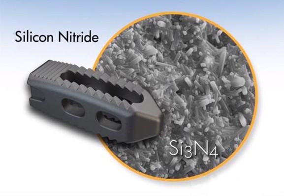 The world's first 3D printed silicon nitride medical implant