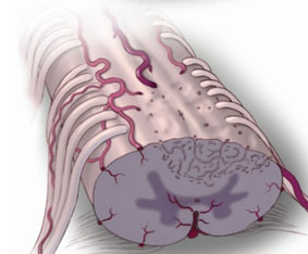 Treatment of spinal cord trauma with transgenic cord blood