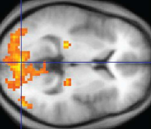 Different neural network systems for mathematical operations and language in the brain