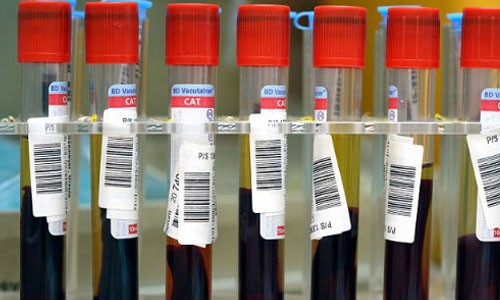 FDA approves the first colorectal cancer blood test reagent