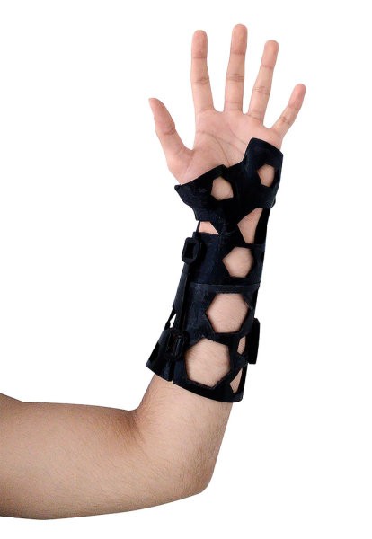 Lighter and safer 3D printed medical splint NovaCast