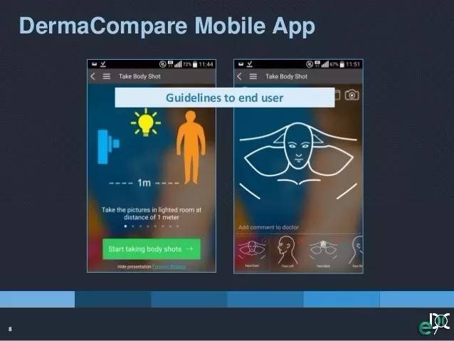 An artificial intelligence app for diagnosing skin cancer