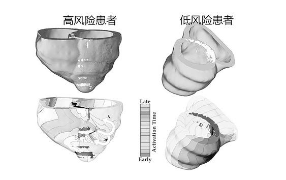 "Virtual Heart" can provide early warning for patients with arrhythmia