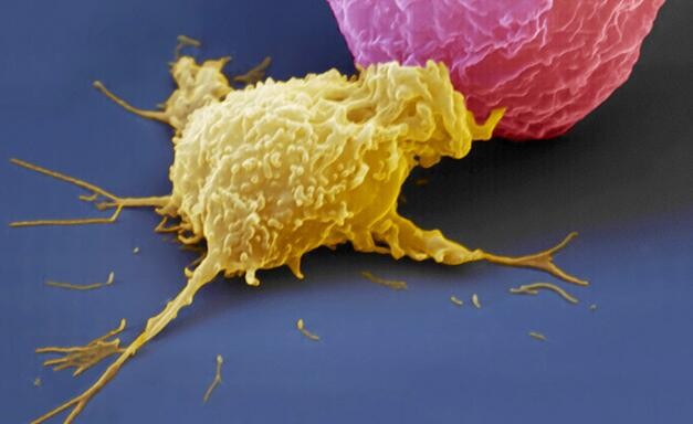 New tools to improve cancer diagnosis