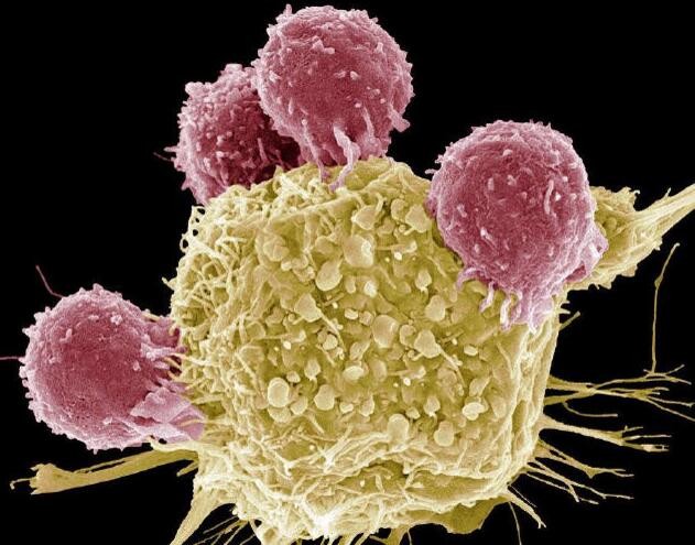 German scientists find new ways to kill liver cancer cells