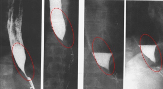 Dynamic DR in the examination of the advantages of digestive medicine