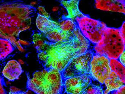 New ways to remove cancer cells