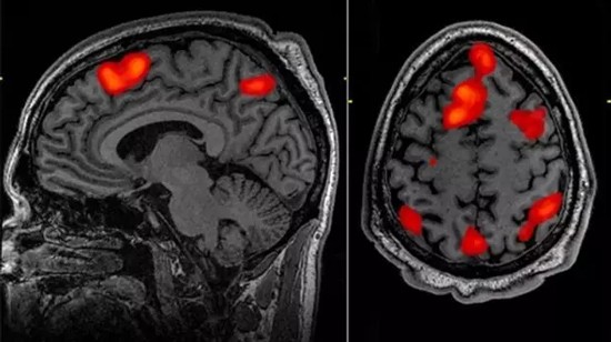 fMRI analysis is exploding major defects Brain science is in trouble