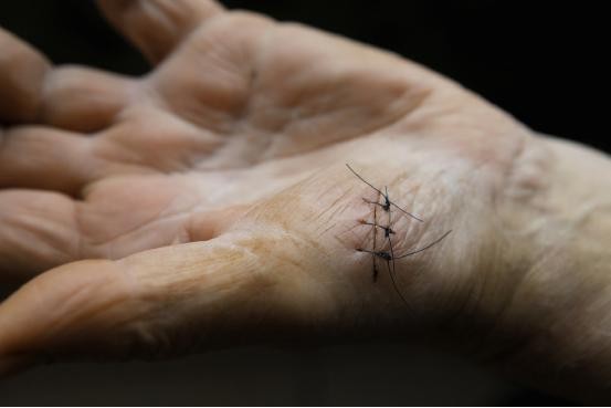 For the first time, researchers have developed "smart" sutures to monitor wound healing.