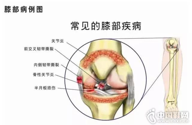 è†éƒ¨ç—…ä¾‹å›¾