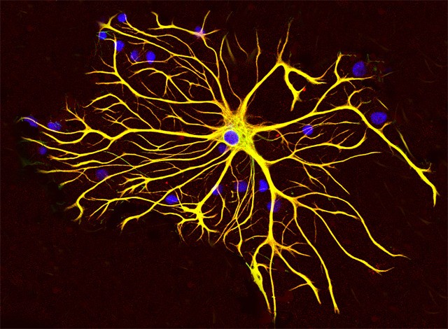 [Shock] Neurons also have "chargers": astrocytes help restore brain damage patients