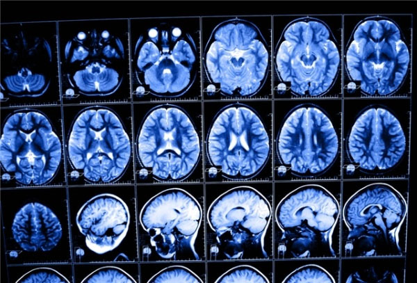 Shocked: Scientists first quantified human IQ through MRI scans