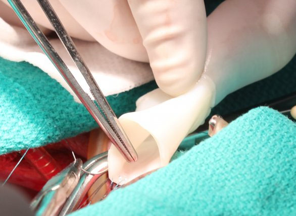 American scientists create bioengineered blood vessels that "grow"