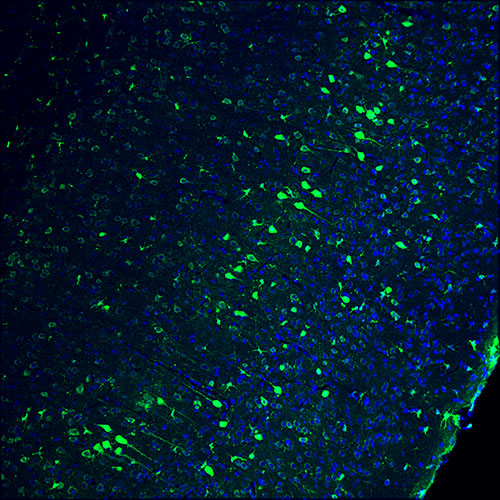 The newly discovered CRISPR gene can edit non-dividing cells arbitrarily