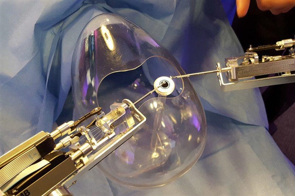 This surgical robot can operate cataract surgery from a microscopic level