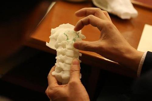 3D printing technology can realize orthopedic rehearsal surgery in advance